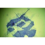 Blåfarvede Collema, Jelly L-celler med uregelmæssige former og fibre vises på en grøn baggrund under mikroskopet.