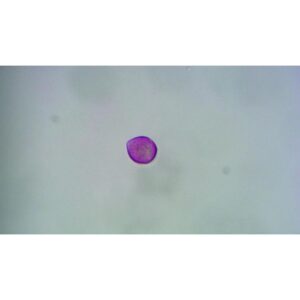 Mikroskopiske præparater: Angiospermer - Eg pollen