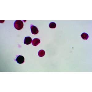 Mikroskopiske præparater: Angiospermer - Poppelpollen