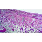 Mikroskopisk billede af en Forberedelsesslide: Hirudo Medicinal farves for at vise cellestrukturer i lilla, pink og blå.