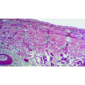 Mikroskopisk billede af en Forberedelsesslide: Hirudo Medicinal farves for at vise cellestrukturer i lilla, pink og blå.