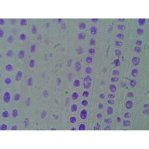 Mikroskopiske præparater: Angiospermer - Mitose rod meristemer af Feulgen hyacint