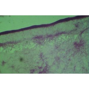 Mikroskopisk billede af Forberedelsesglas: Actinomycetes farvet grønt og lilla, der viser forskellige lag og cellulære strukturer.