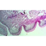 Mikroskopisk billede af Forberedelsesslide: Regnorm viser lagdelte, strukturerede cellestrukturer med pink og lilla farvning.