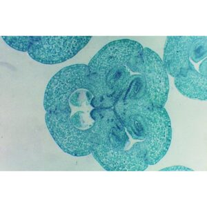 Mikroskopiske præparater: Angiospermer - Lilje æggestok, æg med embryonal sæk