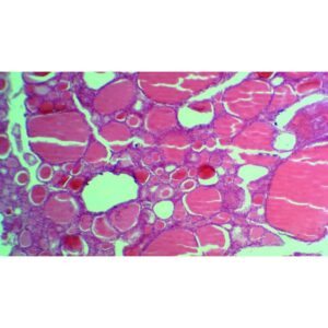 Mikroskopiske præparater: Endokrine celler - Naturlig hyposekretorisk bovin skjoldbruskkirtel