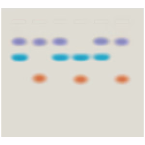 bioteknologi kit Hvem har efterladt DNA?