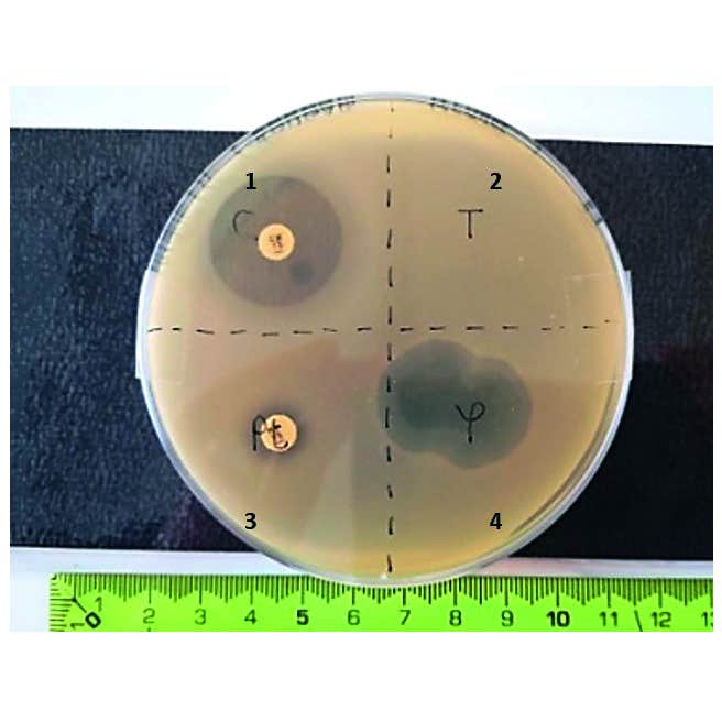 PCR-detektionskit til bakteriofag T4-virus - Jeulin - LabDidakt.dk PCR-detektionskit til bakteriofag T4-virus
