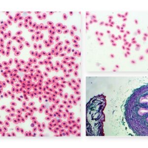 Blod, kredsløb & immunforsvar